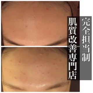 ミディアム カラー パーマ ヘアアレンジ メンズ キッズ ネイル マツエク・マツパ ニキビ・肌質改善専門 ♡人生が変わるサロンのエステ・リラクイメージ