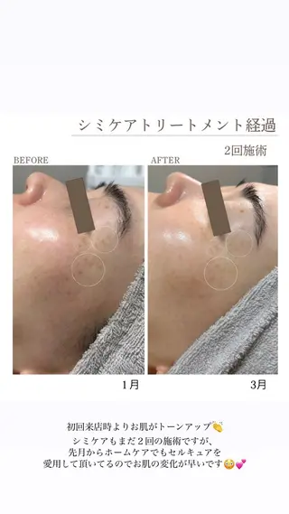 シミケア・肌育サロン Jullyのエステ・リラクイメージ