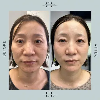 White labo 須谷のエステ・リラクイメージ