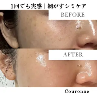 シミ・毛穴ケア専門 クロヌYUKIのエステ・リラクイメージ