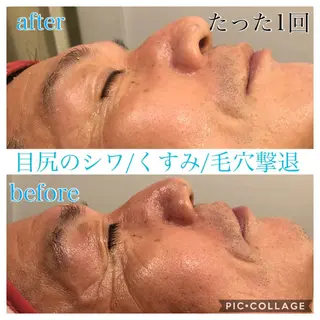 ショート カラー パーマ ヘアアレンジ キッズ ネイル マツエク・マツパ EnsorClair 代表 野口真央のエステ・リラクイメージ