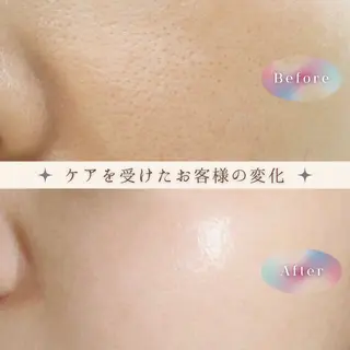 愛維美水光美肌専門店 メンズレディースokのエステ・リラクイメージ