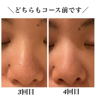 Bellesthe (ベルエステ)のエステ・リラクイメージ