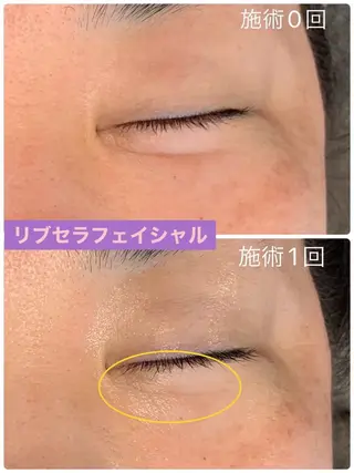 プライベートサロン プリュネルのエステ・リラクイメージ