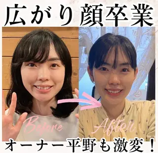 小顔矯正専門 🪽アシュネ平野のエステ・リラクイメージ