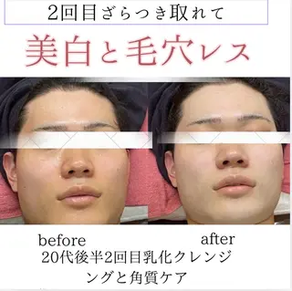 シミニキビ改善 小顔サロンのエステ・リラクイメージ