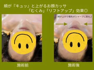 カッサ・カッピング 専門サロン/水玉屋のエステ・リラクイメージ