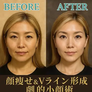 【歴13年】劇的小顔 D rマジックタッチのエステ・リラクイメージ