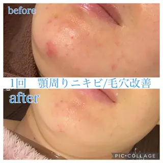 セミロング カラー パーマ ヘアアレンジ ネイル マツエク・マツパ EnsorClair 代表 野口真央のエステ・リラクイメージ