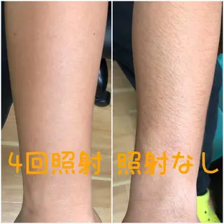 メンズ salon de epilaのエステ・リラクイメージ