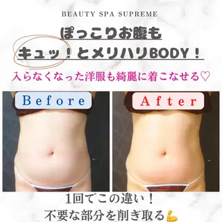 Beauty Spa Supreme小玉のエステ・リラクイメージ