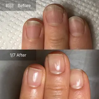 ネイル 木村 千晴のネイルデザイン