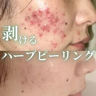 THE PEACH スタッフのエステ・リラクイメージ