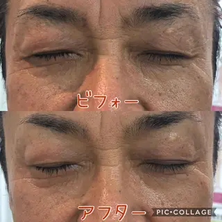 メンズ エステサロン LilyRoseのエステ・リラクイメージ
