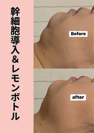 LUMINAルミナ 【肌管理サロン】のその他イメージ