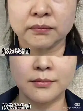マツエク・マツパ 愛維美水光専門店 川崎彩鳳のエステ・リラクイメージ