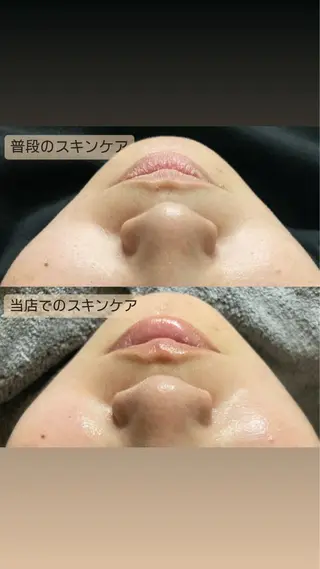磐田|LAYLA 一番丁寧な脱毛店のエステ・リラクイメージ