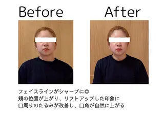 鍼灸師 NARUMIのエステ・リラクイメージ
