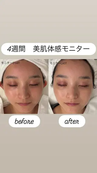 肌育成サロン こまつみなみのエステ・リラクイメージ