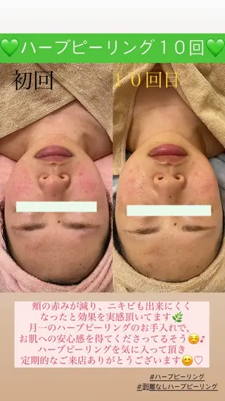 メンズ Salon de Lino 御器所のエステ・リラクイメージ