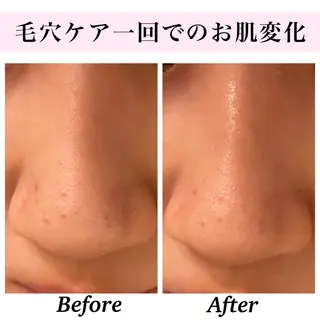 Bellesthe (ベルエステ)のエステ・リラクイメージ