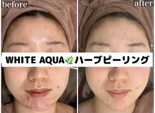 WHITE AQUA 🌼柏店のエステ・リラクイメージ