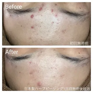 深い肌悩み&早期脱毛 完了サロンのエステ・リラクイメージ
