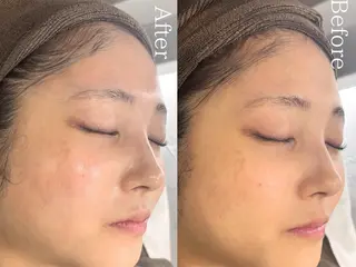 💎Queen Beauty🫧のエステ・リラクイメージ