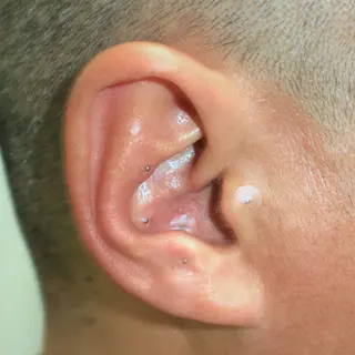 B.napus Nanohaのその他イメージ