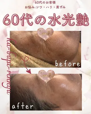 miki 東根の肌質改善サロンのエステ・リラクイメージ