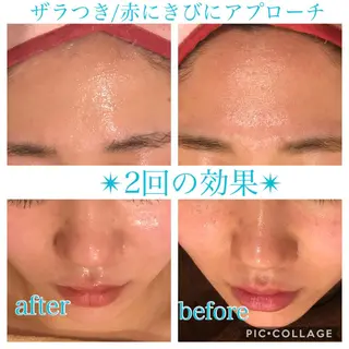 ロング カラー パーマ ヘアアレンジ キッズ ネイル マツエク・マツパ EnsorClair 代表 野口真央のエステ・リラクイメージ