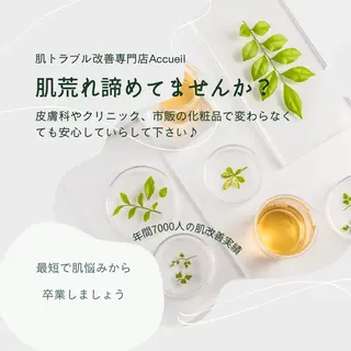 メンズ マツエク・マツパ アイブロウ ニキビ・肌質改善専門 ♡人生が変わるサロンのエステ・リラクイメージ