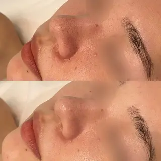 ハーブピーリング専門 BIOPLUS+川崎のエステ・リラクイメージ