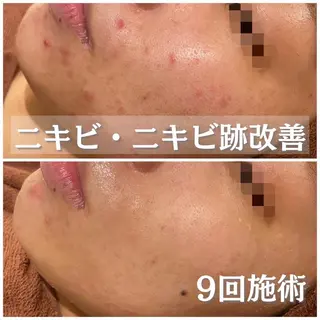 ミディアム カラー パーマ ヘアアレンジ メンズ キッズ マツエク・マツパ アイブロウ ニキビ・肌質改善専門 ♡人生が変わるサロンのエステ・リラクイメージ