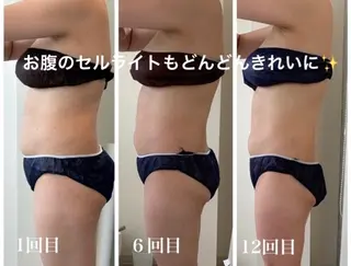 骨盤矯正ダイエット 結果出し＊痩身マシンのエステ・リラクイメージ