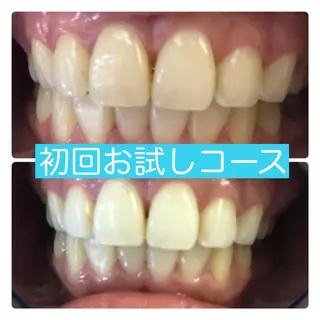 ホワイトニングルーム 横浜店のその他イメージ