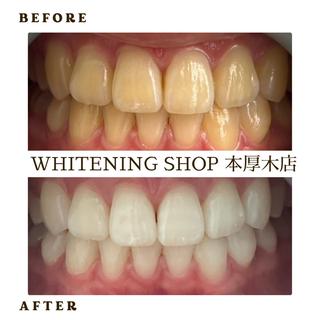 メンズ ホワイトニング ショップ本厚木のその他イメージ
