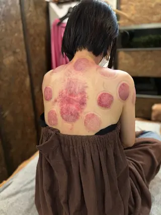 かっさ(刮痧)専門店 心氣院のその他イメージ