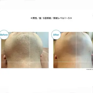 脱毛サロン MiELのエステ・リラクイメージ