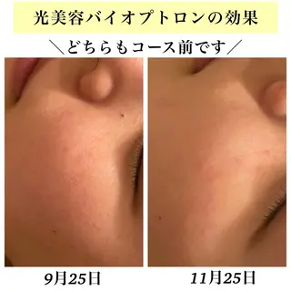 Bellesthe (ベルエステ)のエステ・リラクイメージ