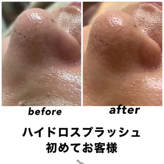 ネイル・エステサロン UILANIのエステ・リラクイメージ
