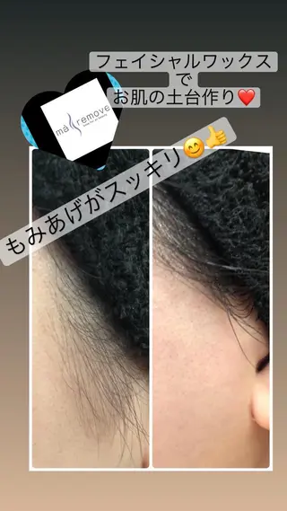 宜野湾美肌脱毛fuu okinawaタイラのエステ・リラクイメージ