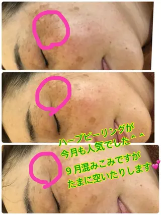 ❤️予約殺到❤️mi オールハンド痩身専門のエステ・リラクイメージ