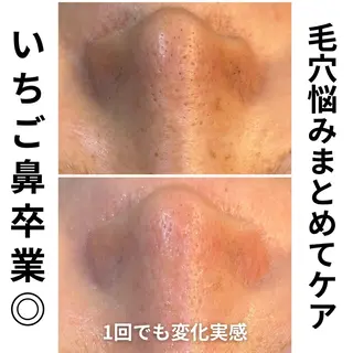 leolo武蔵浦和 肌質改善&脱毛のエステ・リラクイメージ