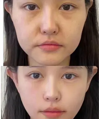 ネイル 愛維美水光専門店 川崎彩鳳のエステ・リラクイメージ