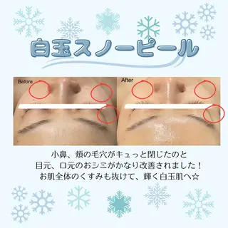 🌷MURA 毛穴・顔脱毛🌷のエステ・リラクイメージ