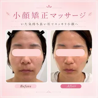 多治米｜オールハンド リラク・痩身・小顔のその他イメージ