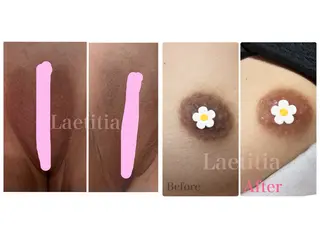レティティア (Laetitia)のエステ・リラクイメージ