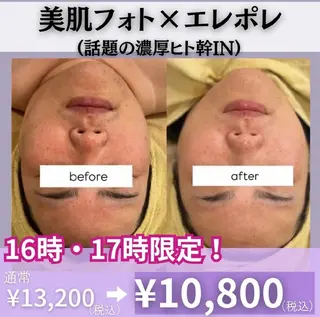 CLAIR 小山店(あき)のエステ・リラクイメージ