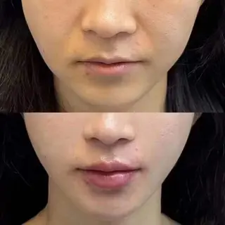 マツエク・マツパ 愛維美水光専門店 川崎彩鳳のエステ・リラクイメージ